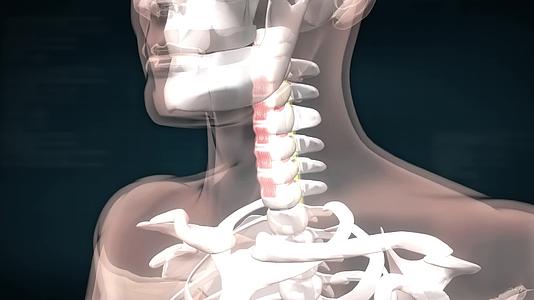颈椎间盘病变康复3D动画演示视频的预览图