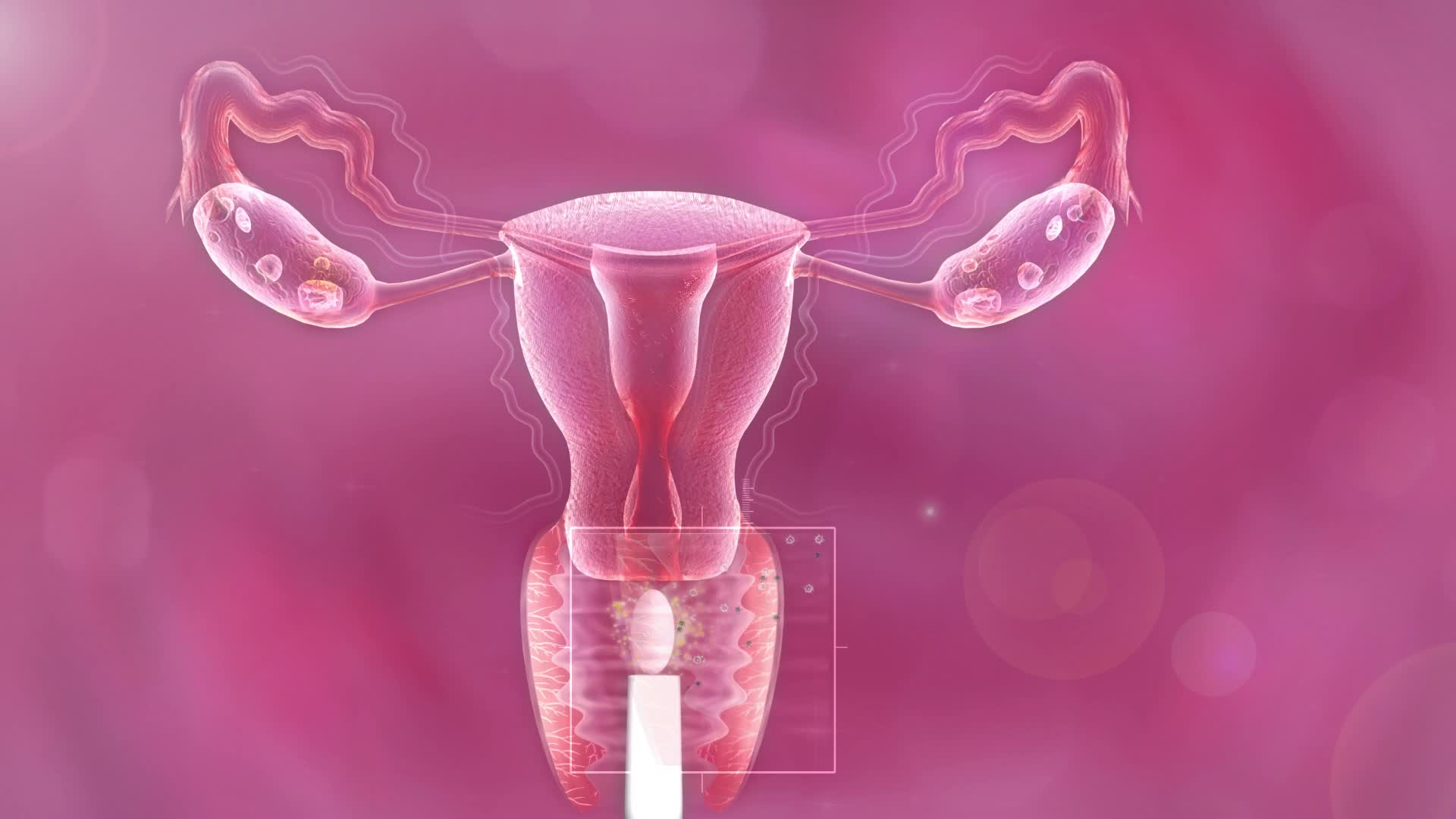 女性生殖系统再生粘膜使敏感和弹性增强视频的预览图