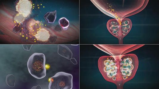药物进入前列腺穿透病菌细胞核消除致病菌视频的预览图