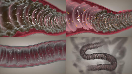 益生菌清理肠道宿便毒素平衡菌群视频的预览图