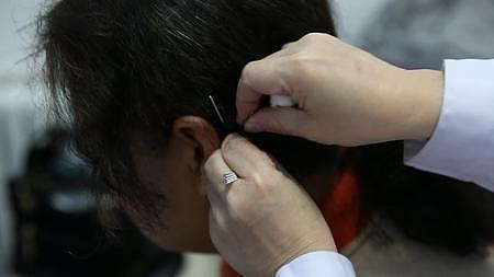 中医给一位女性患者的耳朵穴位针灸进行健康养生治疗疾病视频的预览图