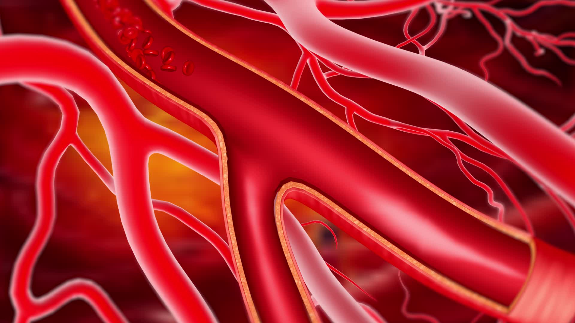 形成血栓的血管动画视频的预览图