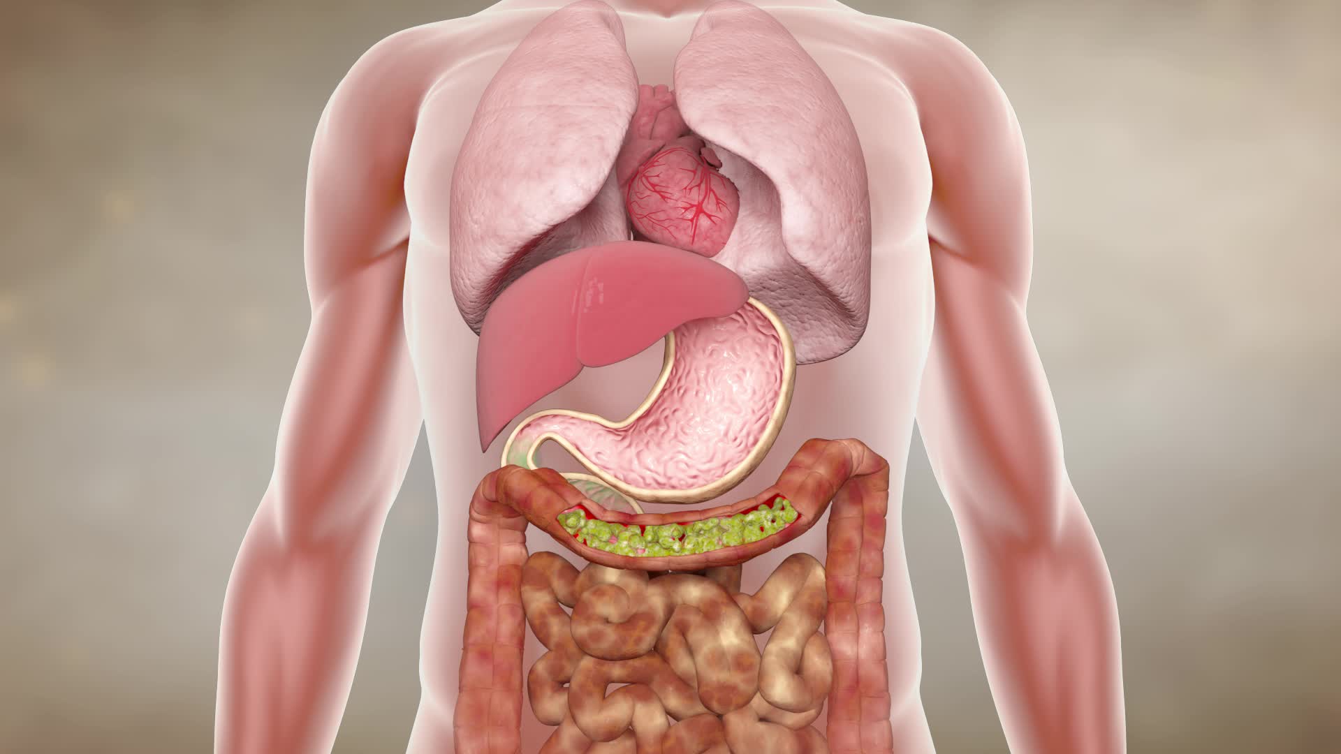 肠胃病人体器官动画视频的预览图