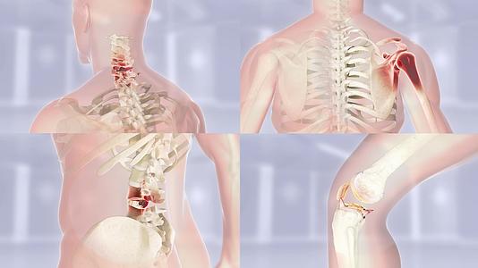 颈肩腰腿人体关节模拟动画素材视频的预览图