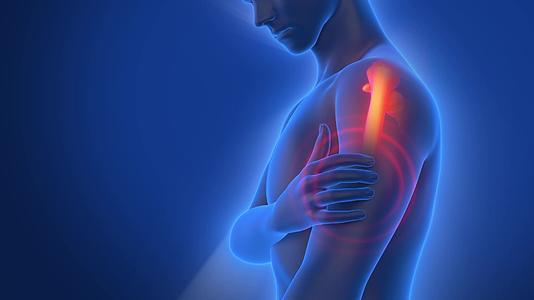 肩周炎肩膀疼痛三维模拟动画视频的预览图