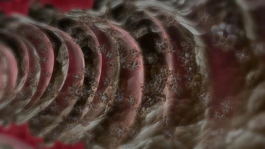 肠道宿便毒素在人体扩散降低免疫力视频的预览图