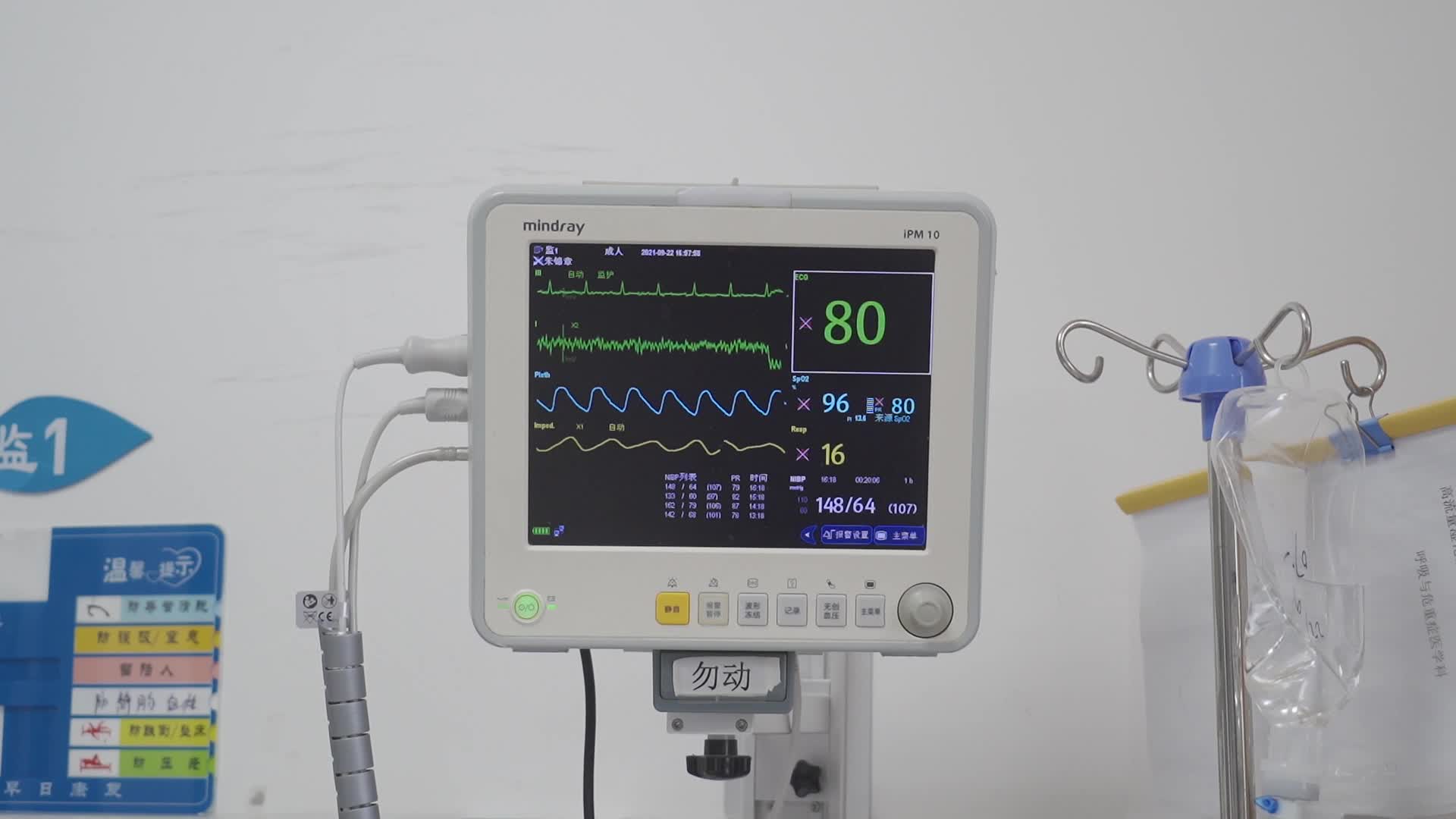 重症监护室心电图检测仪器视频的预览图