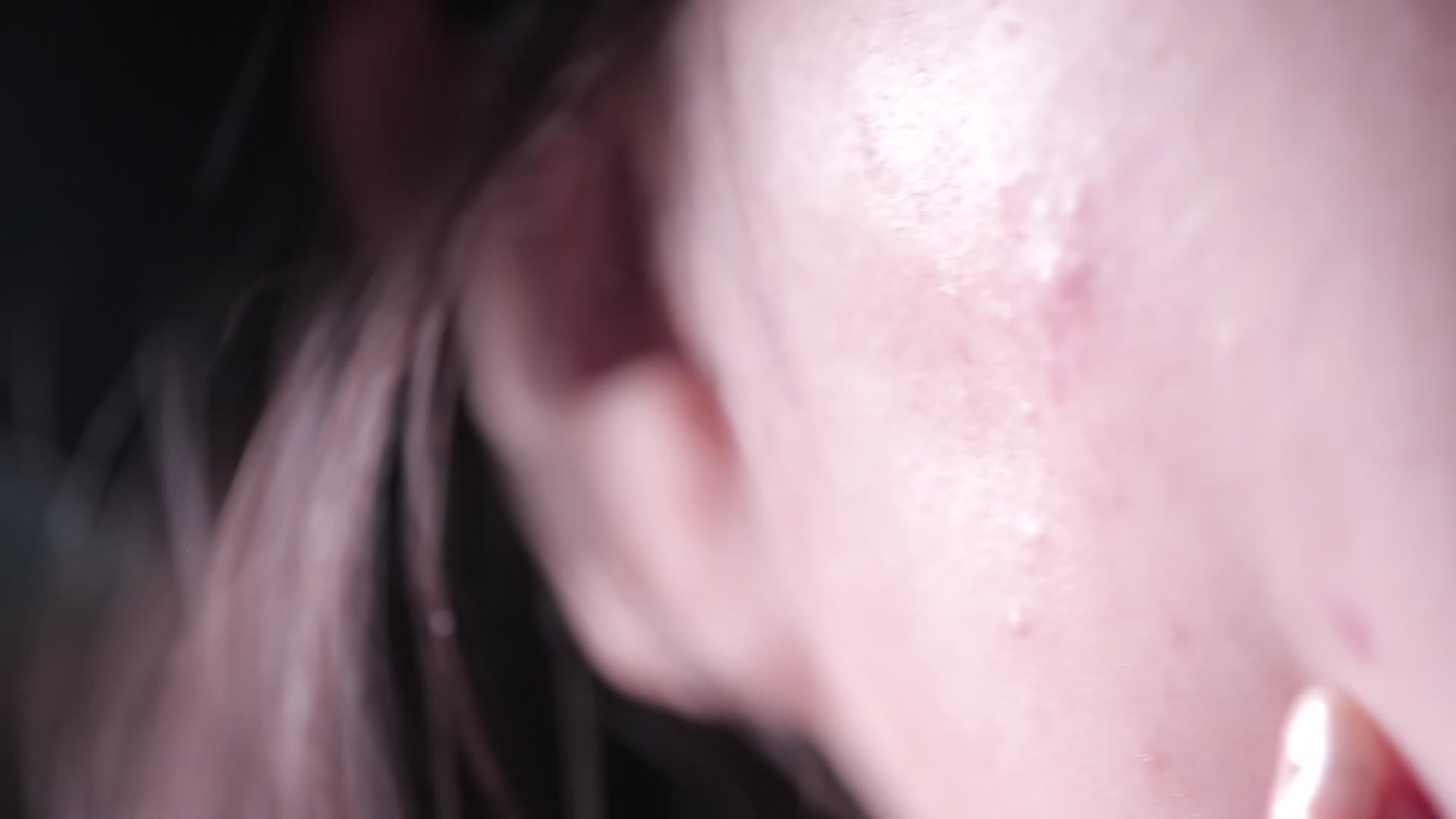 皮肤问题痤疮长痘痘印视频的预览图