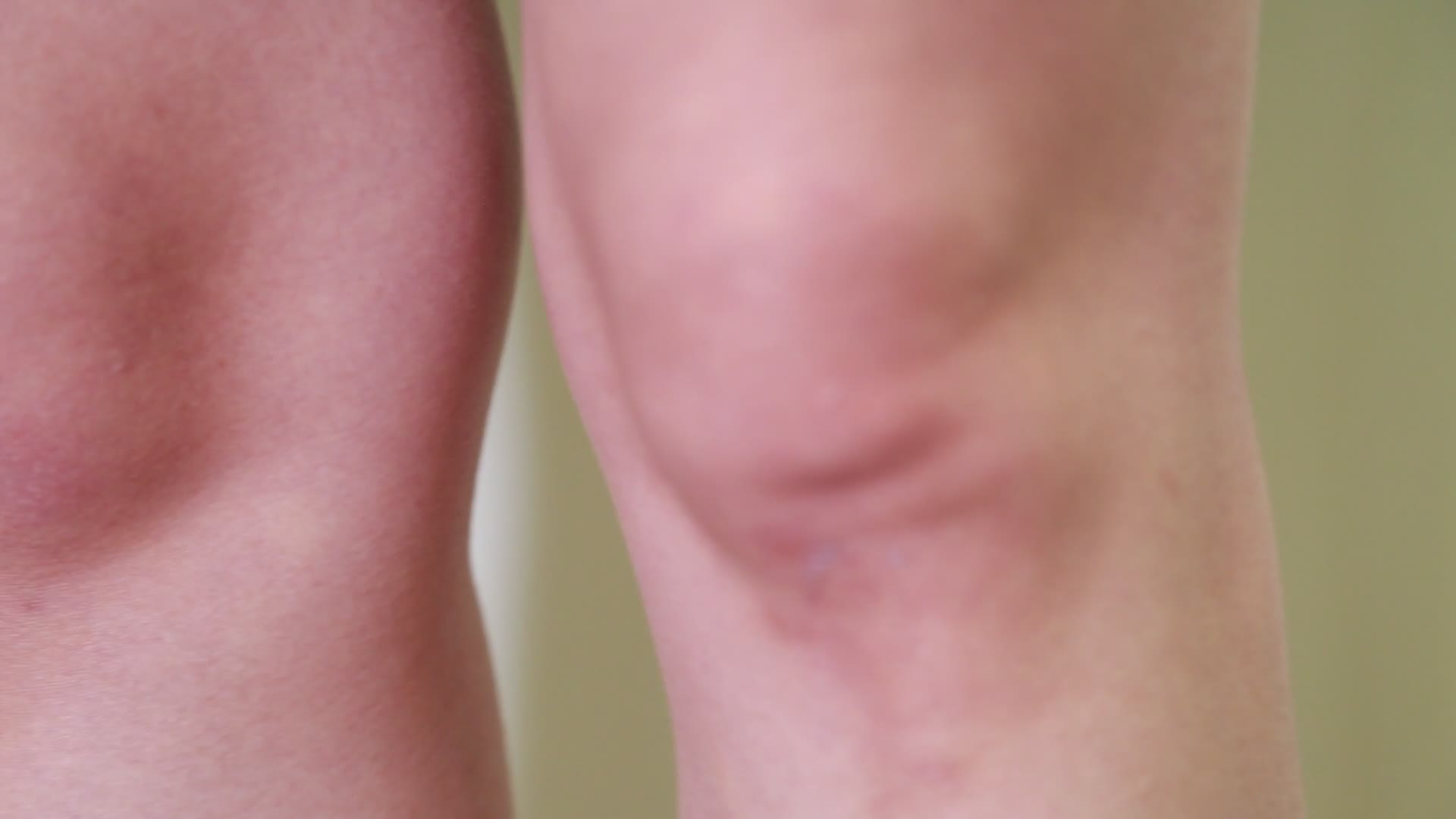 女性腿部穴位按摩膝盖视频的预览图