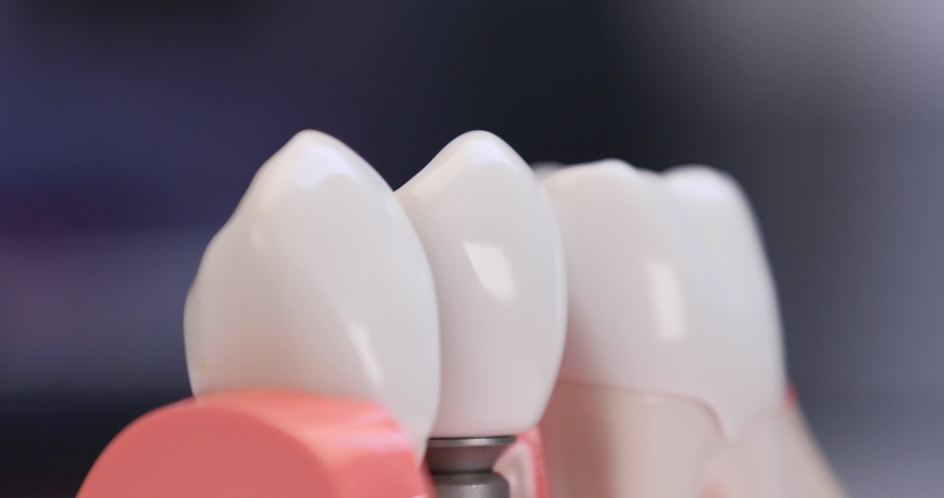 医疗口腔牙齿模型特写4K实拍视频视频的预览图