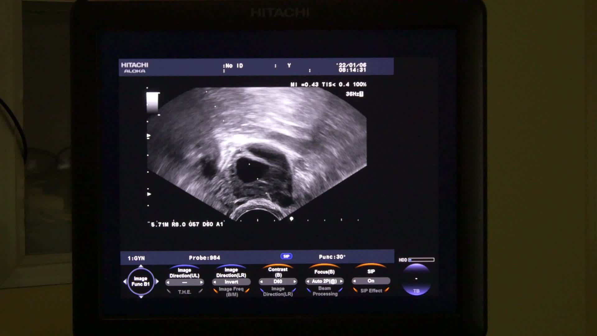 医疗放射科B超视频的预览图