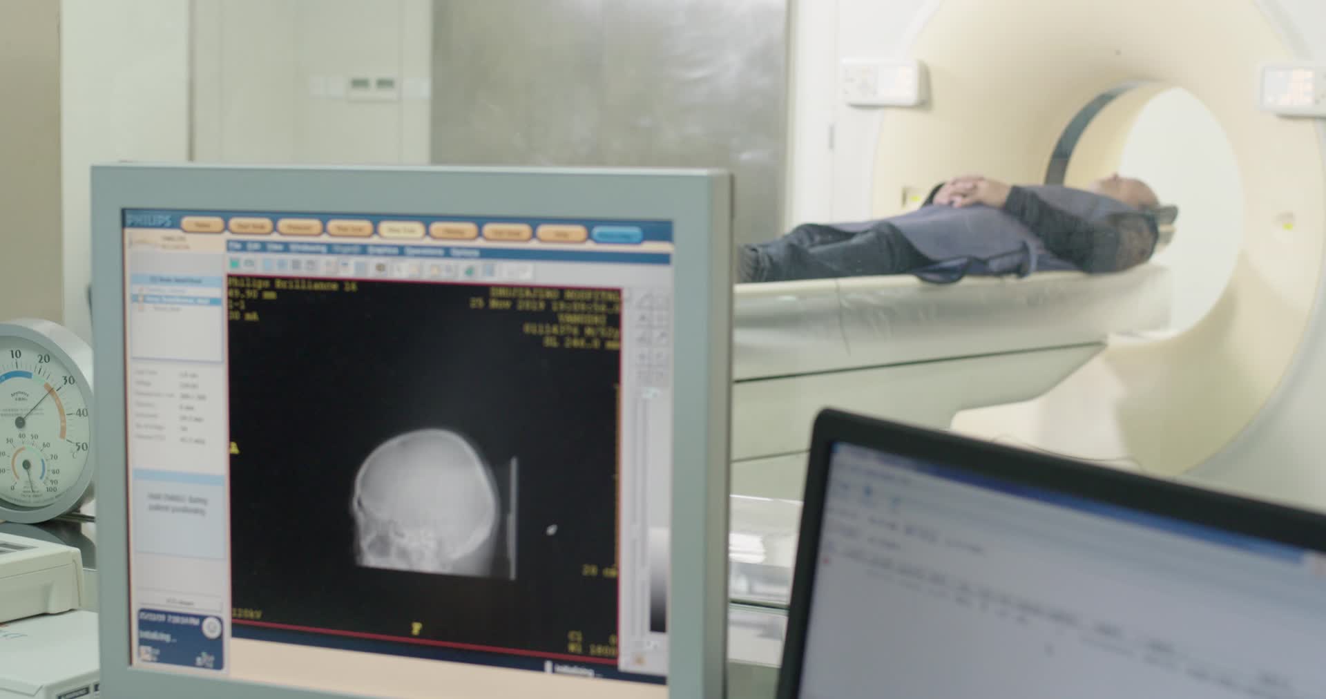 医院医疗脑CT扫描病人4K视频视频的预览图