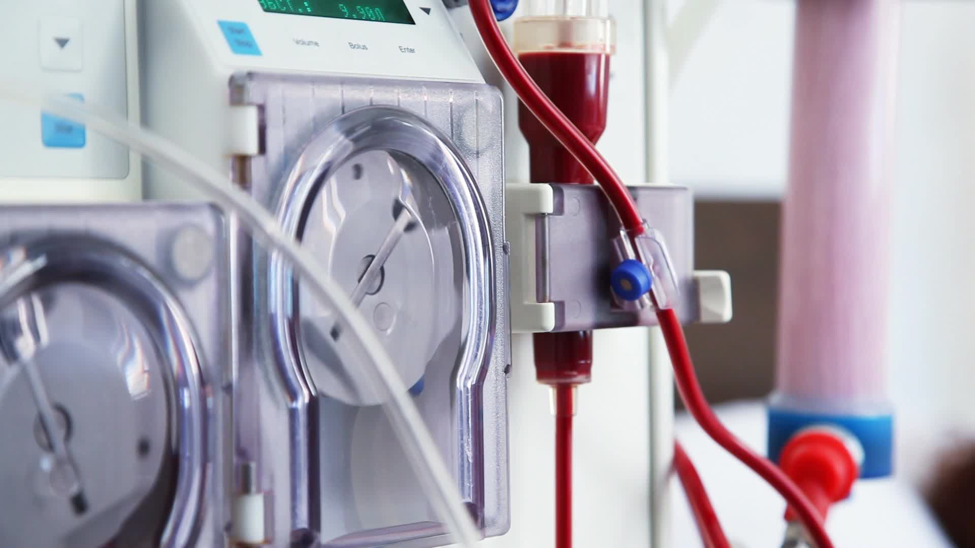血液透析医疗设备视频的预览图