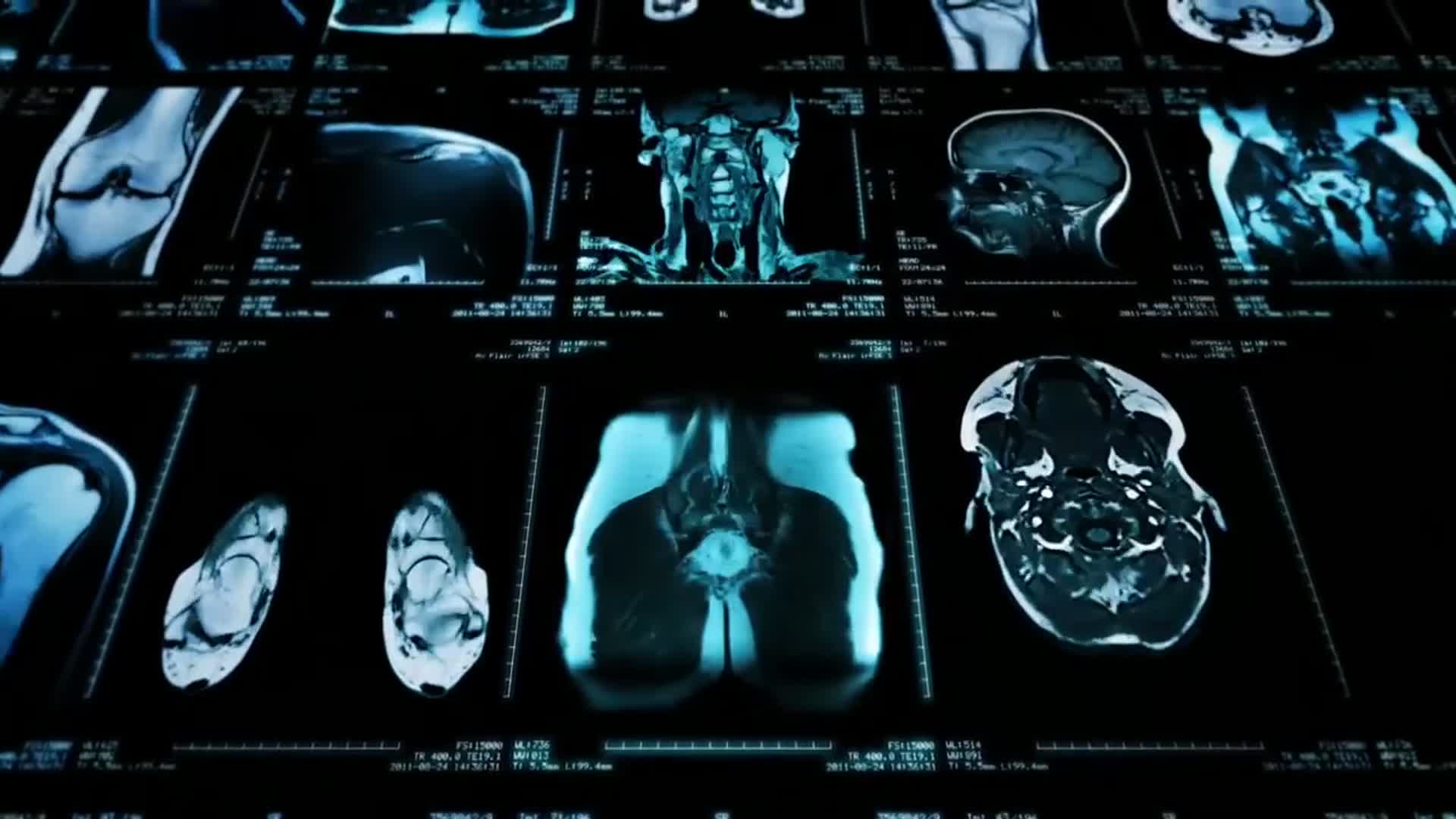 先进医疗科技医学视频大合集视频的预览图