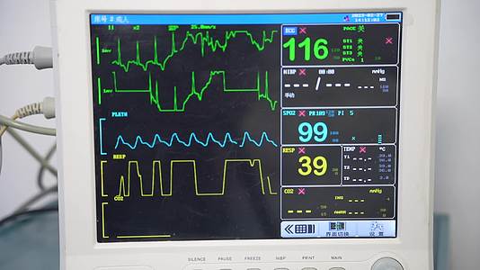 医院身体心脉搏率检测仪视频的预览图