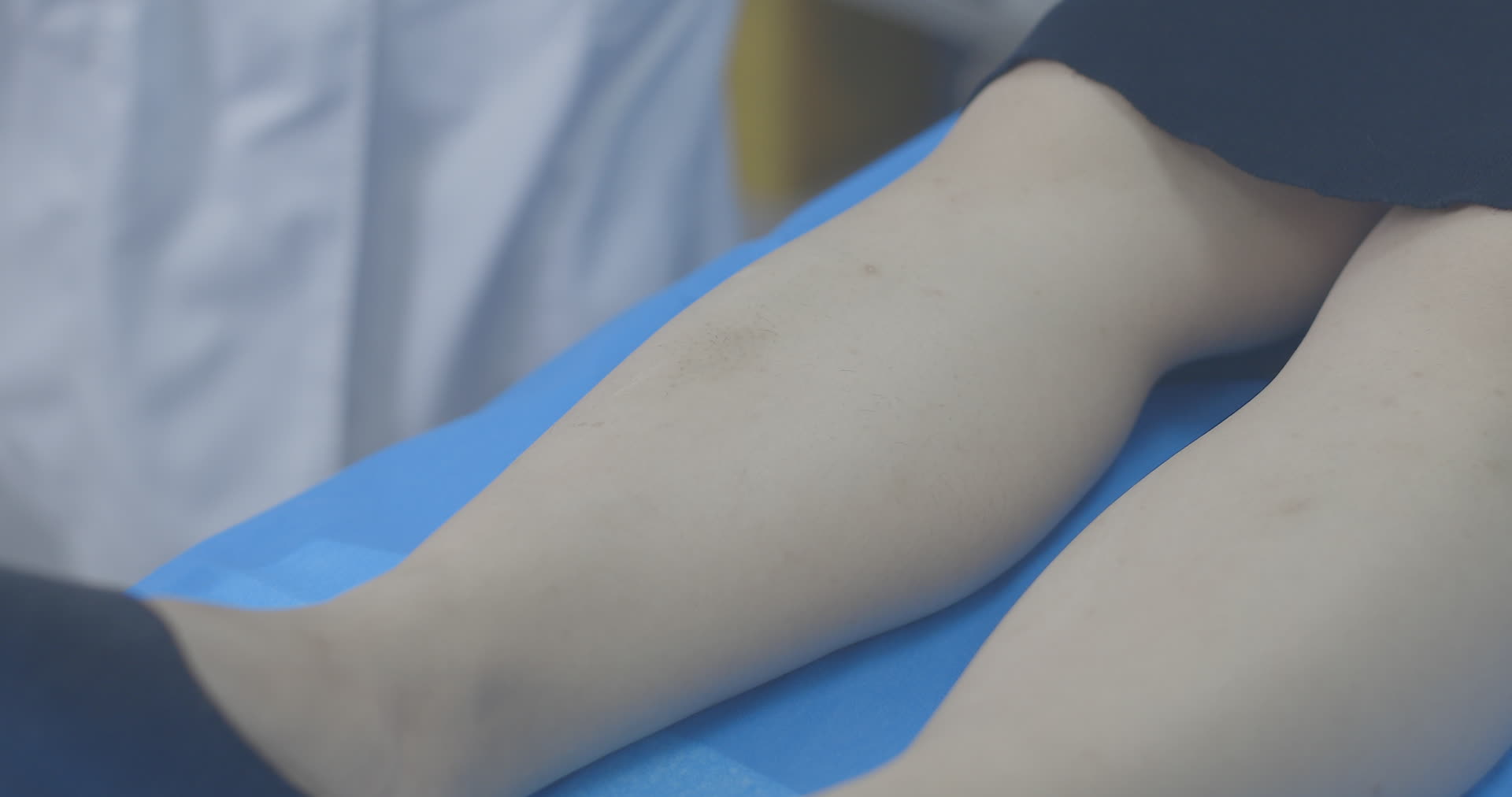 医生为患者敷药视频的预览图