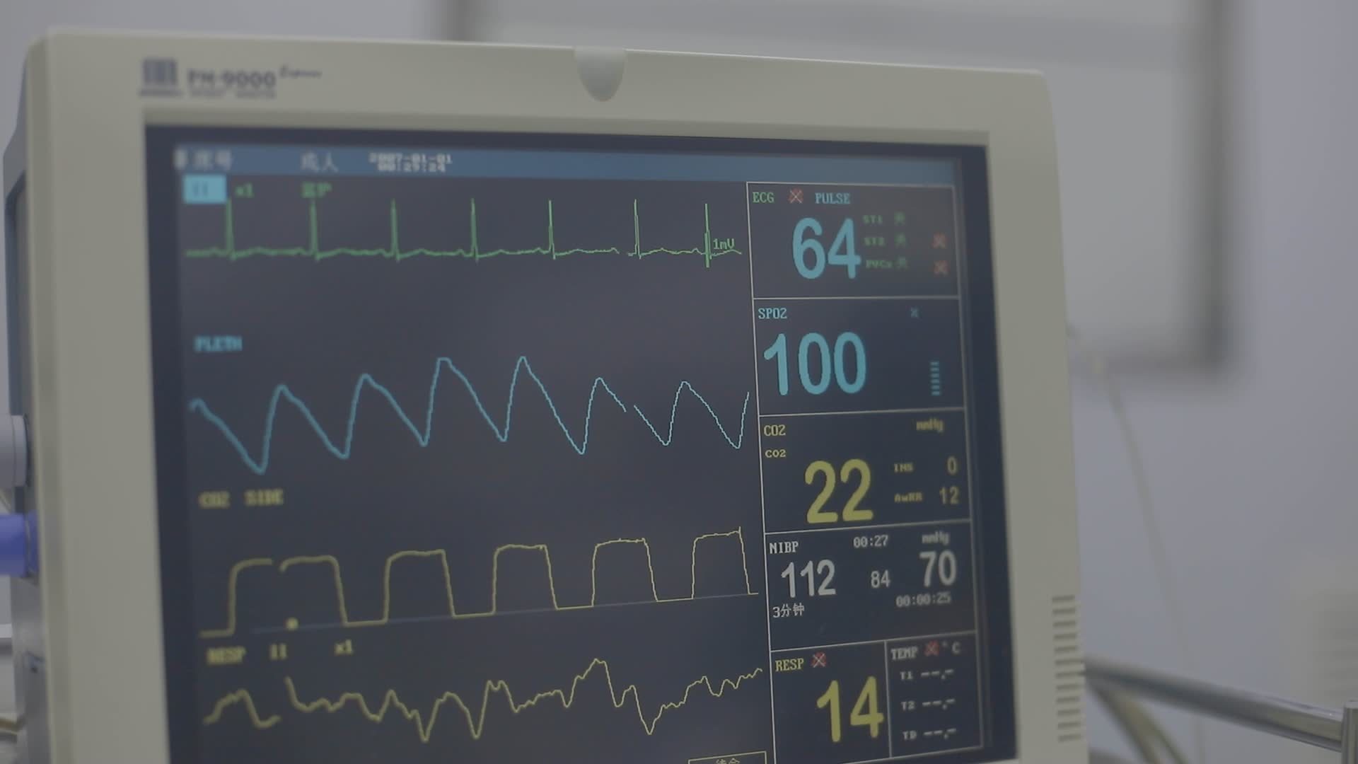 手术室心电图视频的预览图